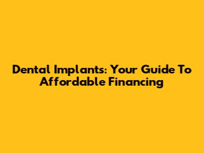 Dental Implants: Your Guide To Affordable Financing