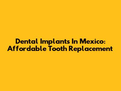 Dental Implants In Mexico: Affordable Tooth Replacement