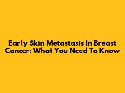 Early Skin Metastasis In Breast Cancer: What You Need To Know