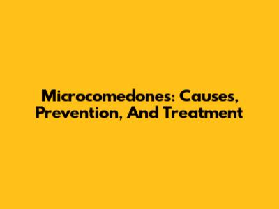 Microcomedones: Causes, Prevention, And Treatment