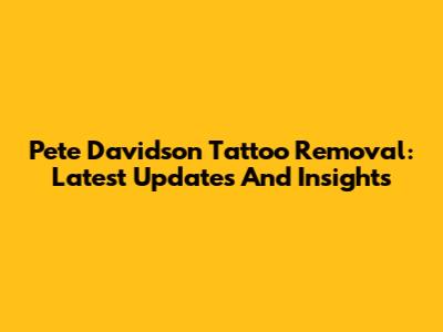 Pete Davidson Tattoo Removal: Latest Updates And Insights